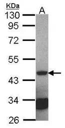 Anti-Septin 2 antibody [N1N3] used in Western Blot (WB). GTX101693
