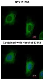 Anti-TTC1 antibody used in Immunocytochemistry/ Immunofluorescence (ICC/IF). GTX101698
