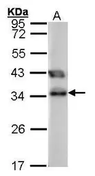 Anti-TTC1 antibody used in Western Blot (WB). GTX101698