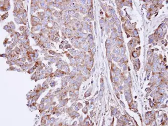 Anti-SGSH antibody [C1C3] used in IHC (Paraffin sections) (IHC-P). GTX101700