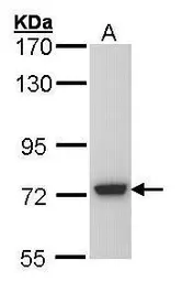 Anti-SGSH antibody [C1C3] used in Western Blot (WB). GTX101700