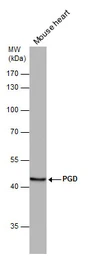 Anti-PGD antibody [N1N3] used in Western Blot (WB). GTX101703