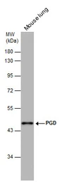 Anti-PGD antibody [N1N3] used in Western Blot (WB). GTX101703
