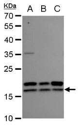 Anti-nm23-H2 antibody used in Western Blot (WB). GTX101706