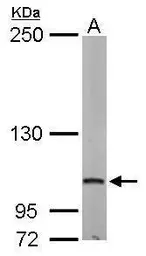 Anti-DAP5 antibody used in Western Blot (WB). GTX101710