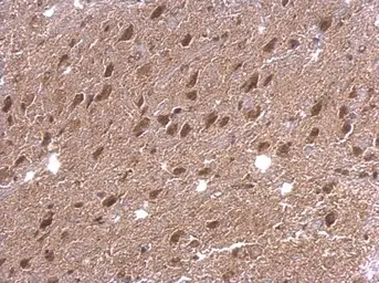Anti-DAP5 antibody used in IHC (Paraffin sections) (IHC-P). GTX101710