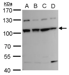 Anti-DAP5 antibody used in Western Blot (WB). GTX101710