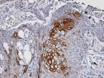 Anti-DAP5 antibody used in IHC (Paraffin sections) (IHC-P). GTX101710