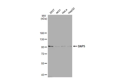 Anti-DAP5 antibody [C2C3], C-term used in Western Blot (WB). GTX101712