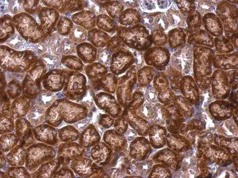 Anti-DAP5 antibody [C2C3], C-term used in IHC (Paraffin sections) (IHC-P). GTX101712
