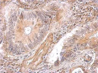 Anti-DAP5 antibody [C2C3], C-term used in IHC (Paraffin sections) (IHC-P). GTX101712