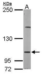Anti-DAP5 antibody [C2C3], C-term used in Western Blot (WB). GTX101712