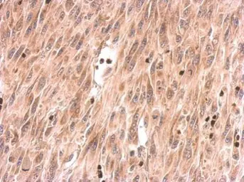 Anti-SOS2 antibody used in IHC (Paraffin sections) (IHC-P). GTX101723