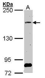 Anti-SOS2 antibody used in Western Blot (WB). GTX101723
