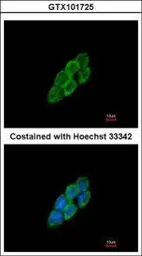 Anti-LTBP4 antibody [N1N2], N-term used in Immunocytochemistry/ Immunofluorescence (ICC/IF). GTX101725