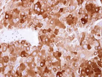 Anti-LTBP4 antibody [N1N2], N-term used in IHC (Paraffin sections) (IHC-P). GTX101725