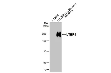 Anti-LTBP4 antibody [N1N2], N-term used in Western Blot (WB). GTX101725