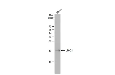Anti-LMO1 antibody used in Western Blot (WB). GTX101726