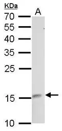 Anti-LMO1 antibody used in Western Blot (WB). GTX101726