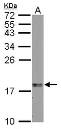 Anti-LMO1 antibody used in Western Blot (WB). GTX101726