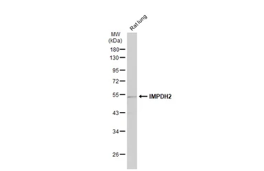 Anti-IMPDH2 antibody [N2C1], Internal used in Western Blot (WB). GTX101727