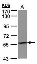 Anti-IMPDH2 antibody [N2C1], Internal used in Western Blot (WB). GTX101727
