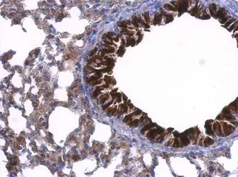 Anti-GDI1 antibody used in IHC (Paraffin sections) (IHC-P). GTX101731