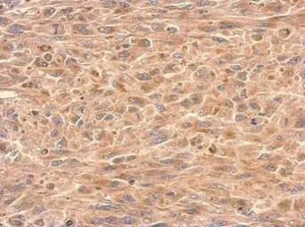 Anti-GDI1 antibody used in IHC (Paraffin sections) (IHC-P). GTX101731
