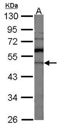 Anti-GDI1 antibody used in Western Blot (WB). GTX101731