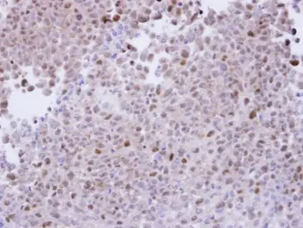 Anti-PSMA7 antibody [N1C3] used in IHC (Paraffin sections) (IHC-P). GTX101745