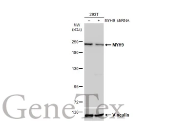 Anti-MYH9 antibody [N1], N-term used in Western Blot (WB). GTX101751