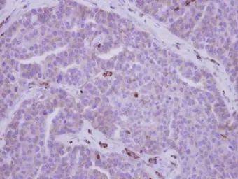 Anti-MYH9 antibody [N1], N-term used in IHC (Paraffin sections) (IHC-P). GTX101751
