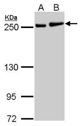Anti-MYH9 antibody [N1], N-term used in Western Blot (WB). GTX101751