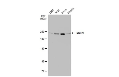 Anti-MYH9 antibody [N1], N-term used in Western Blot (WB). GTX101751
