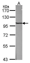 Anti-beta-Adaptin antibody [N3C1], Internal used in Western Blot (WB). GTX101753