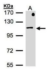 Anti-beta-Adaptin antibody [N3C1], Internal used in Western Blot (WB). GTX101753