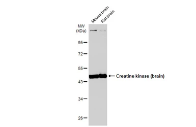 Anti-Creatine kinase (brain) antibody [N1C1] used in Western Blot (WB). GTX101759
