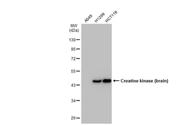 Anti-Creatine kinase (brain) antibody [N1C1] used in Western Blot (WB). GTX101759