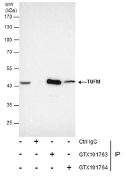 Anti-TUFM antibody used in Immunoprecipitation (IP). GTX101763