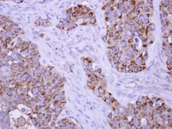 Anti-TUFM antibody used in IHC (Paraffin sections) (IHC-P). GTX101763