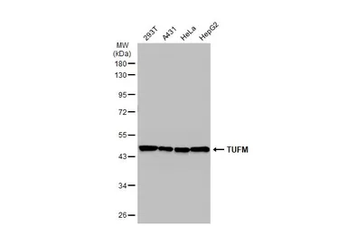 Anti-TUFM antibody used in Western Blot (WB). GTX101763