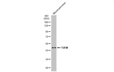 Anti-TUFM antibody used in Western Blot (WB). GTX101763