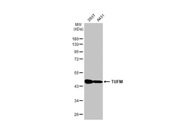 Anti-TUFM antibody used in Western Blot (WB). GTX101763