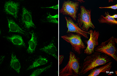 Anti-TUFM antibody used in Immunocytochemistry/ Immunofluorescence (ICC/IF). GTX101763