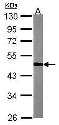 Anti-TUFM antibody used in Western Blot (WB). GTX101763
