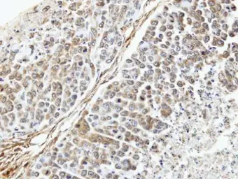 Anti-TUFM antibody [N3C3] used in IHC (Paraffin sections) (IHC-P). GTX101764