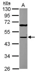 Anti-TUFM antibody [N3C3] used in Western Blot (WB). GTX101764