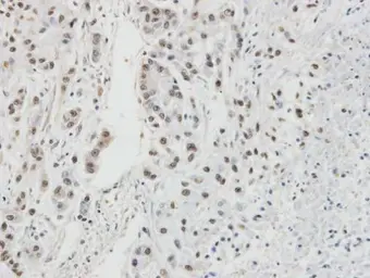 Anti-RPA32 antibody [N1C3] used in IHC (Paraffin sections) (IHC-P). GTX101765