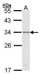 Anti-RPA32 antibody [N1C3] used in Western Blot (WB). GTX101765