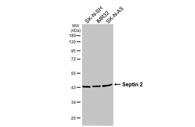 Anti-Septin 2 antibody used in Western Blot (WB). GTX101774